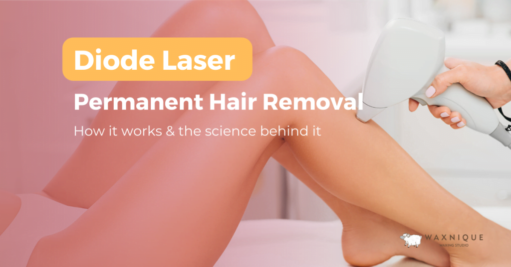 diode laser: permanent hair removal